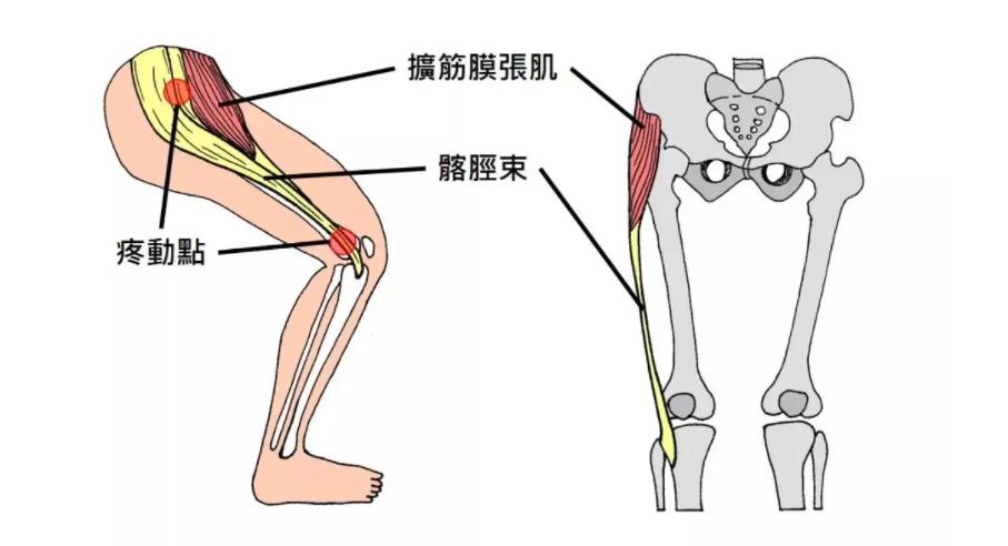 大腿痛是怎么回事是否是肌肉拉伤