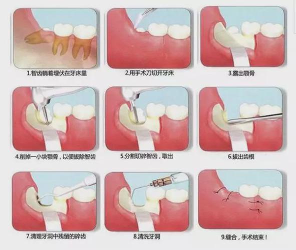 智齿的作用是挤牙缝